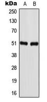 Polyclonal Rabbit anti-Human GABRA1 Antibody (Internal, WB)