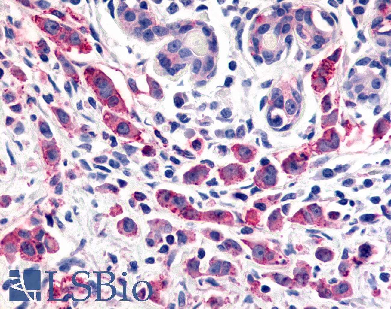 PathPlus™ ADGRL4 / ELTD1 Antibody (N-Terminus)