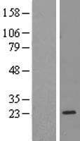 RPL17 / Ribosomal Protein L17 (Over-Expression Lysate Myc-DDK (Flag))