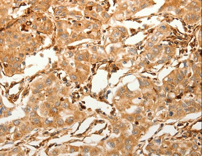 SFRP1 Antibody