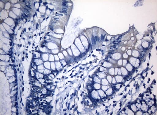 RAB3IP / RABIN3 Antibody (clone OTI5F2)