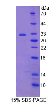 Human PTPRQ Protein (Recombinant His, N-Terminal)