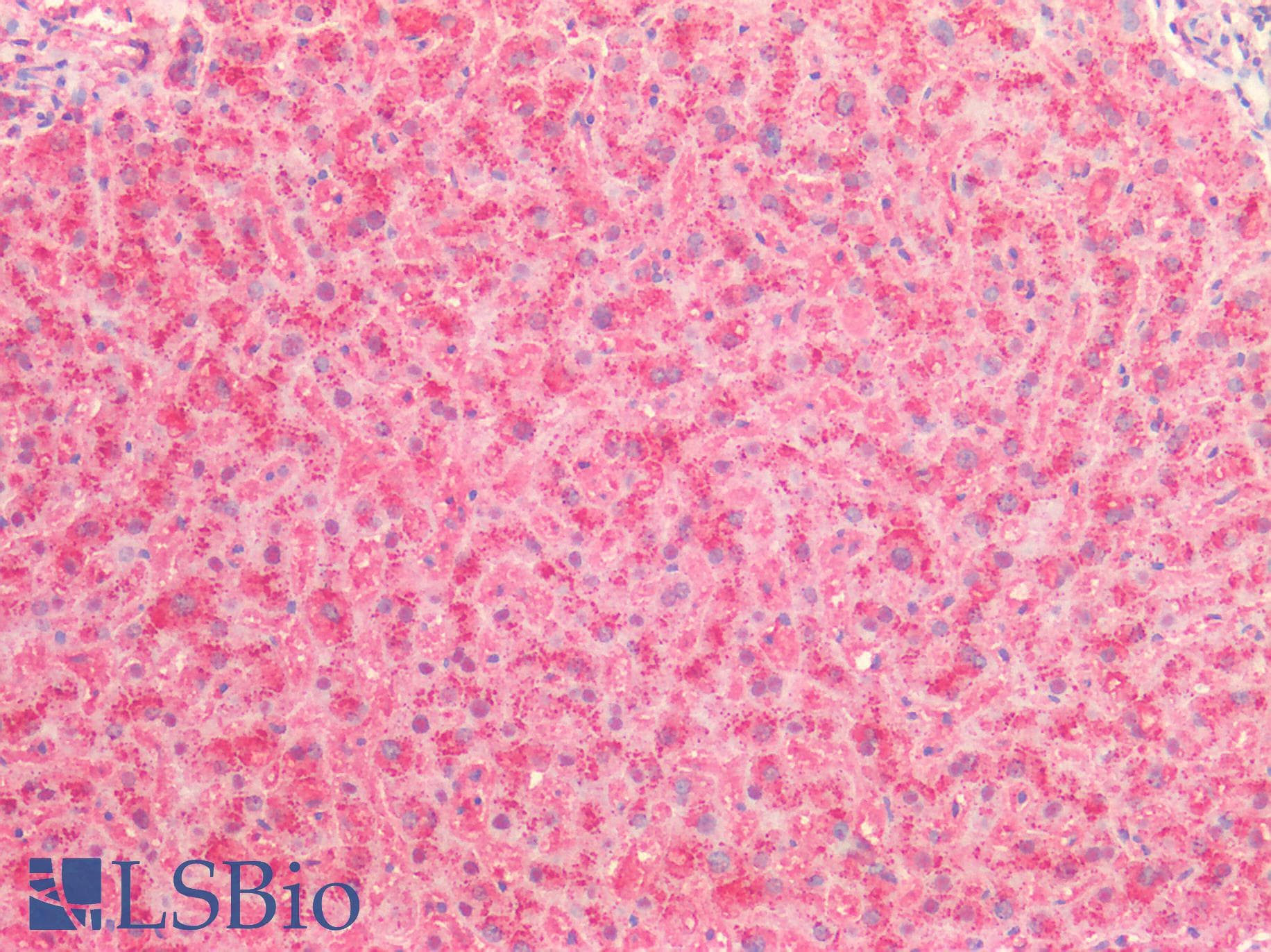 IHC-plus™ Polyclonal Rabbit anti-Human CTSB / Cathepsin B Antibody (IHC)
