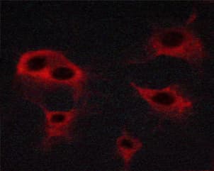 KDR / VEGFR2 / FLK1 Antibody (phospho-Tyr951)