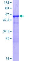 Human PRPS2 Protein (Recombinant GST)