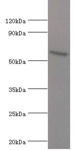 Polyclonal Rabbit anti-Human ATG16L1 / ATG16L Antibody (aa90-300, IHC, WB)