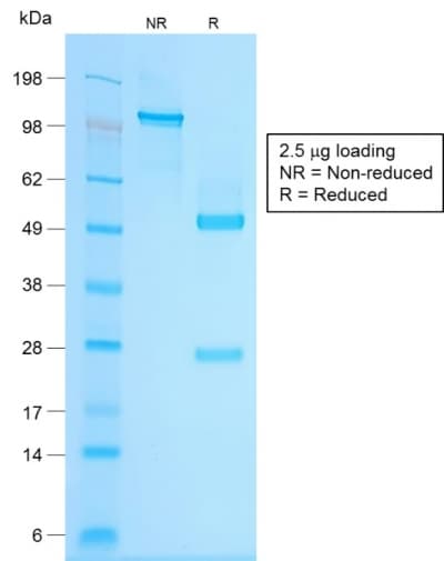 PathPlus™ Recombinant Monoclonal Rabbit anti-Human CHGA / Chromogranin A Antibody (clone CHGA/1815R, IHC)