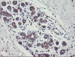PHKG2 Antibody (aa1-216, clone OTI1F9)