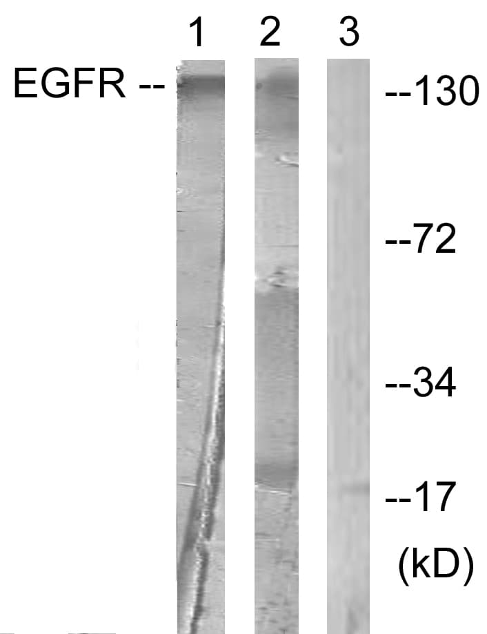 EGFR Antibody (aa986-1035)