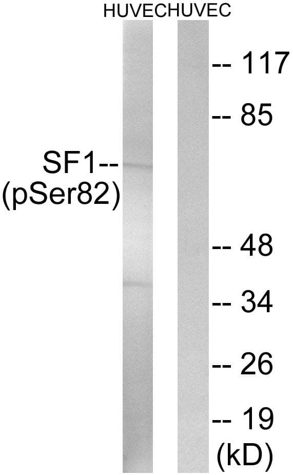 SF1 Antibody (phospho-Ser82)