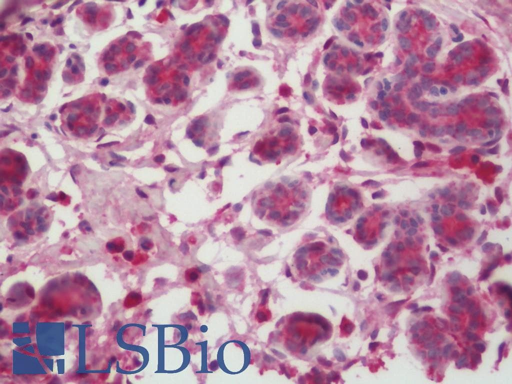 IHC-plus™ Polyclonal Rabbit anti-Human Casein Antibody (IHC)