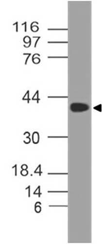 SETD7 / SET7 Antibody