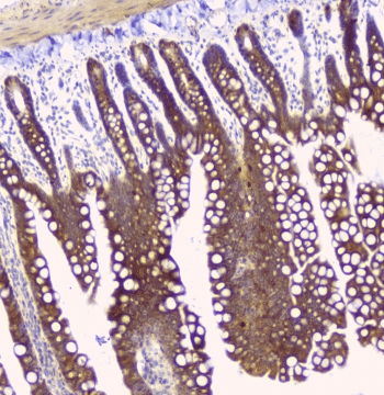 HAS1 / HAS Antibody