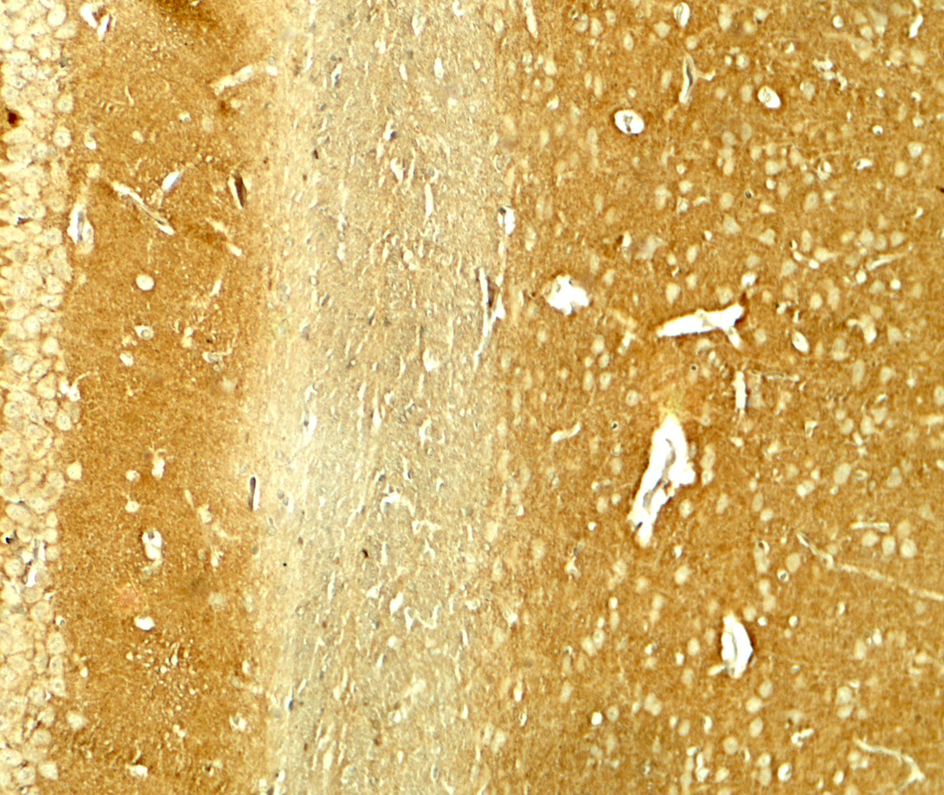 IHC-plus™ SNCA / Alpha-Synuclein Antibody