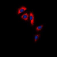 ACO1 / Aconitase Antibody (N-Terminus)