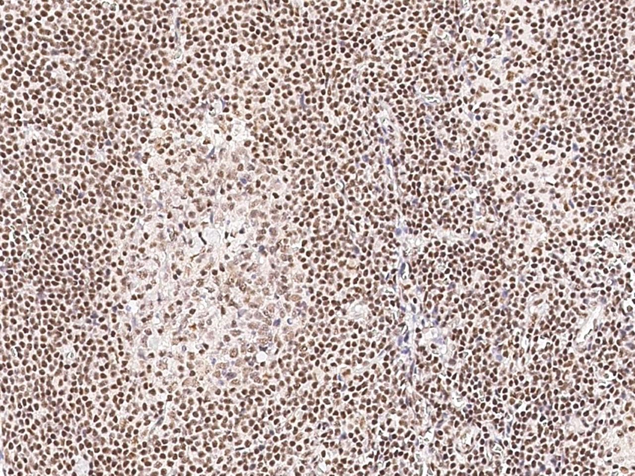Polyclonal Rabbit anti-Human NR2C2 / TAK1 Antibody (Preservative Free, IHC, IF)