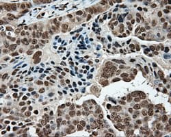MCL1 / MCL 1 Antibody (clone OTI3A12)