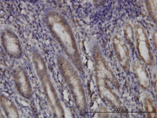 DHODH Antibody (clone 6E1)