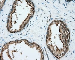 DNTTIP1 / TDIF1 Antibody (clone OTI1E2)