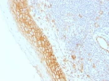 CTNNB1 / Beta Catenin Antibody (clone CTNNB1/1509, Azide-free, BSA-free)