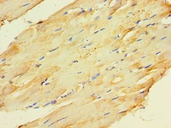 Polyclonal Rabbit anti-Human CKMT2 Antibody (aa40-230, IHC, WB)