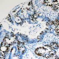 PIAS1 Antibody (N-Terminus)