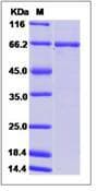 Human ABL1 / c-ABL Protein (Recombinant GST, N-terminus)