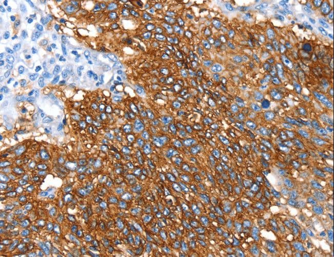 SNX5 Antibody