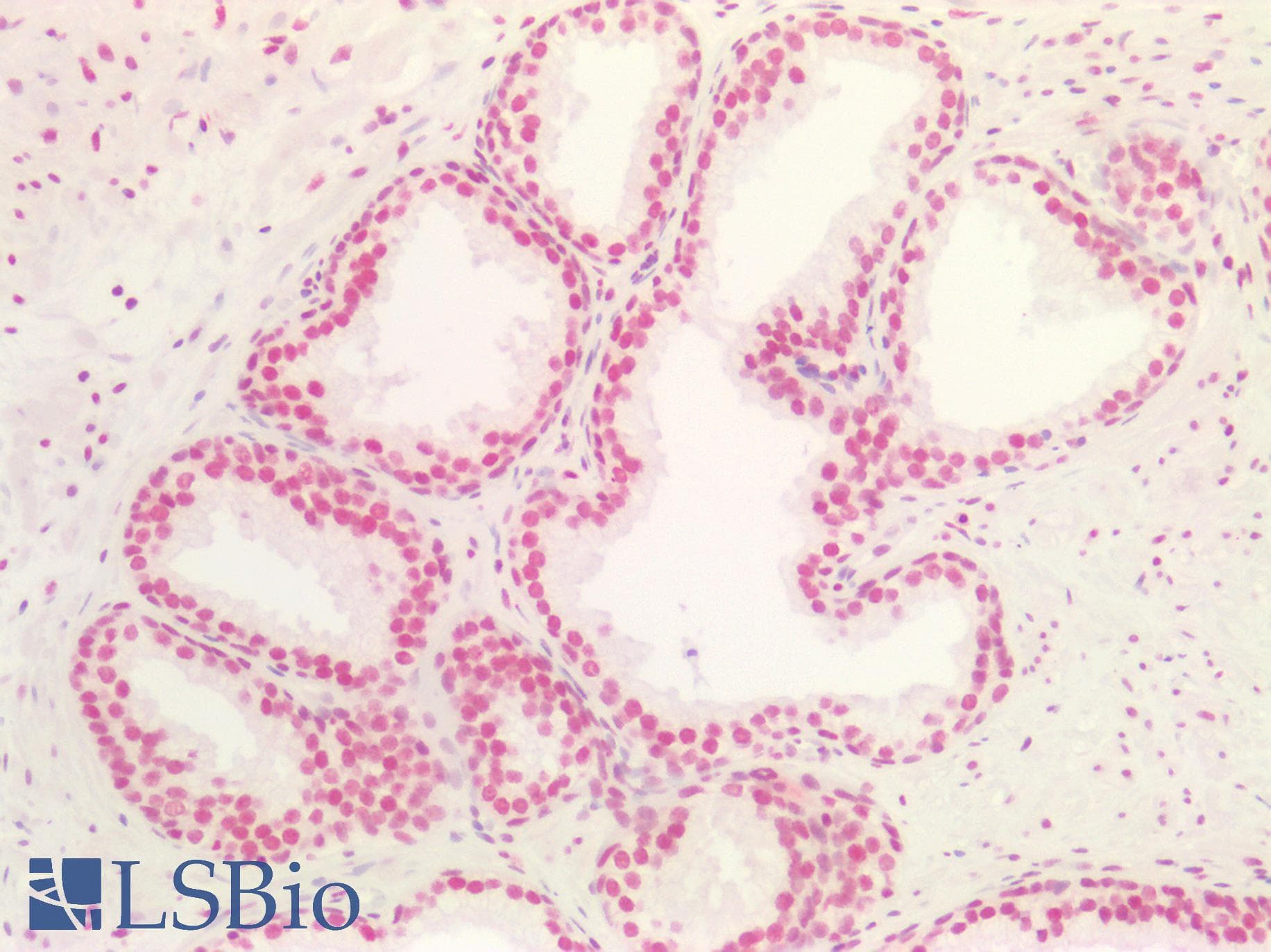 PathPlus™ MAX Antibody (aa147-160)