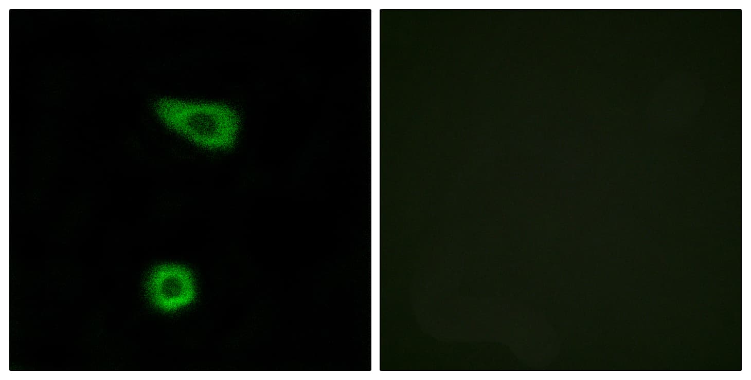 TNFAIP2 Antibody (aa131-180)