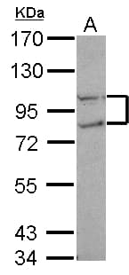 Polyclonal Rabbit anti-Human CTDP1 / FCP1 Antibody (N-Terminus, WB)