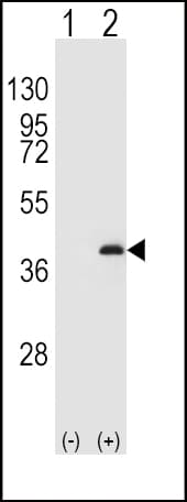 PPP1CB Antibody (aa286-315)
