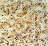 GNS Antibody (aa174-203)