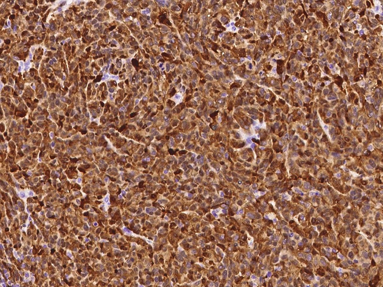 S100B / S100 Beta Antibody (clone 034, Preservative Free)