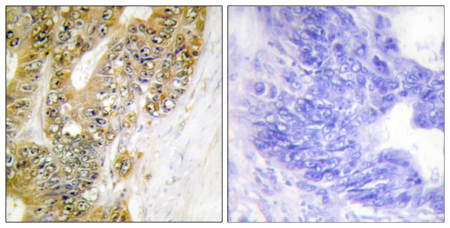 MDM2 Antibody (aa151-200)