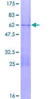 Human TERF2 / TRF2 Protein (Recombinant GST)