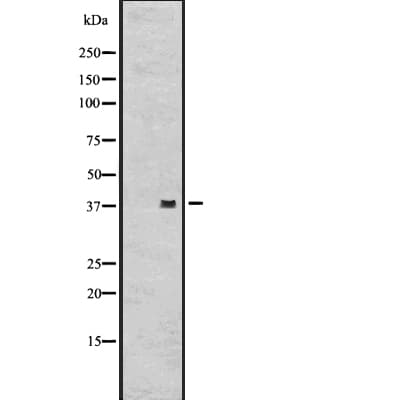 GPR62 Antibody