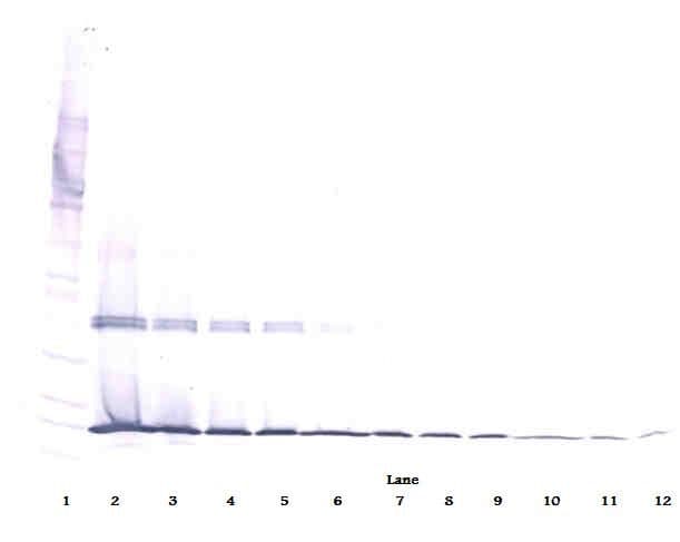 IL-1B / IL-1 Beta Antibody