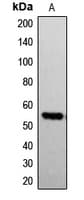 G3BP1 / G3BP Antibody (phospho-Ser232)