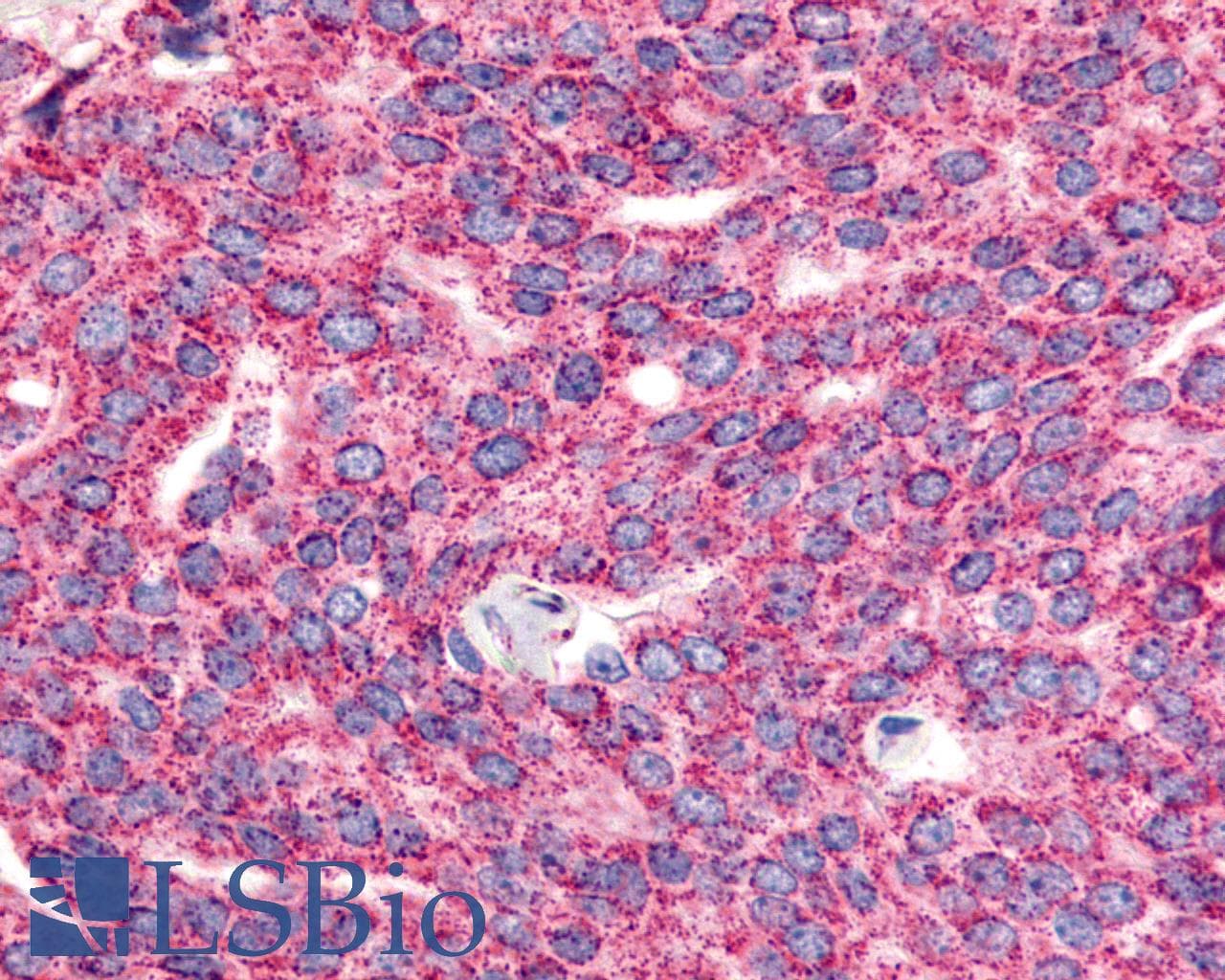 PathPlus™ ADGRG6 / GPR126 Antibody (C-Terminus)