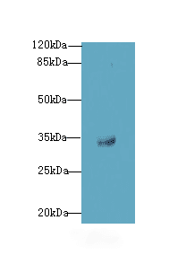 OSER1 / C20orf111 Antibody
