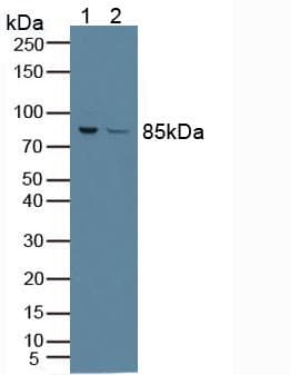 PFKP Antibody (aa247-473, Cy3)