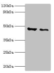 PLIN2 / ADFP / Adipophilin Antibody (aa168-437)