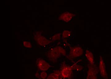 Polyclonal Rabbit anti-Human ZNF187 Antibody (IF, WB)