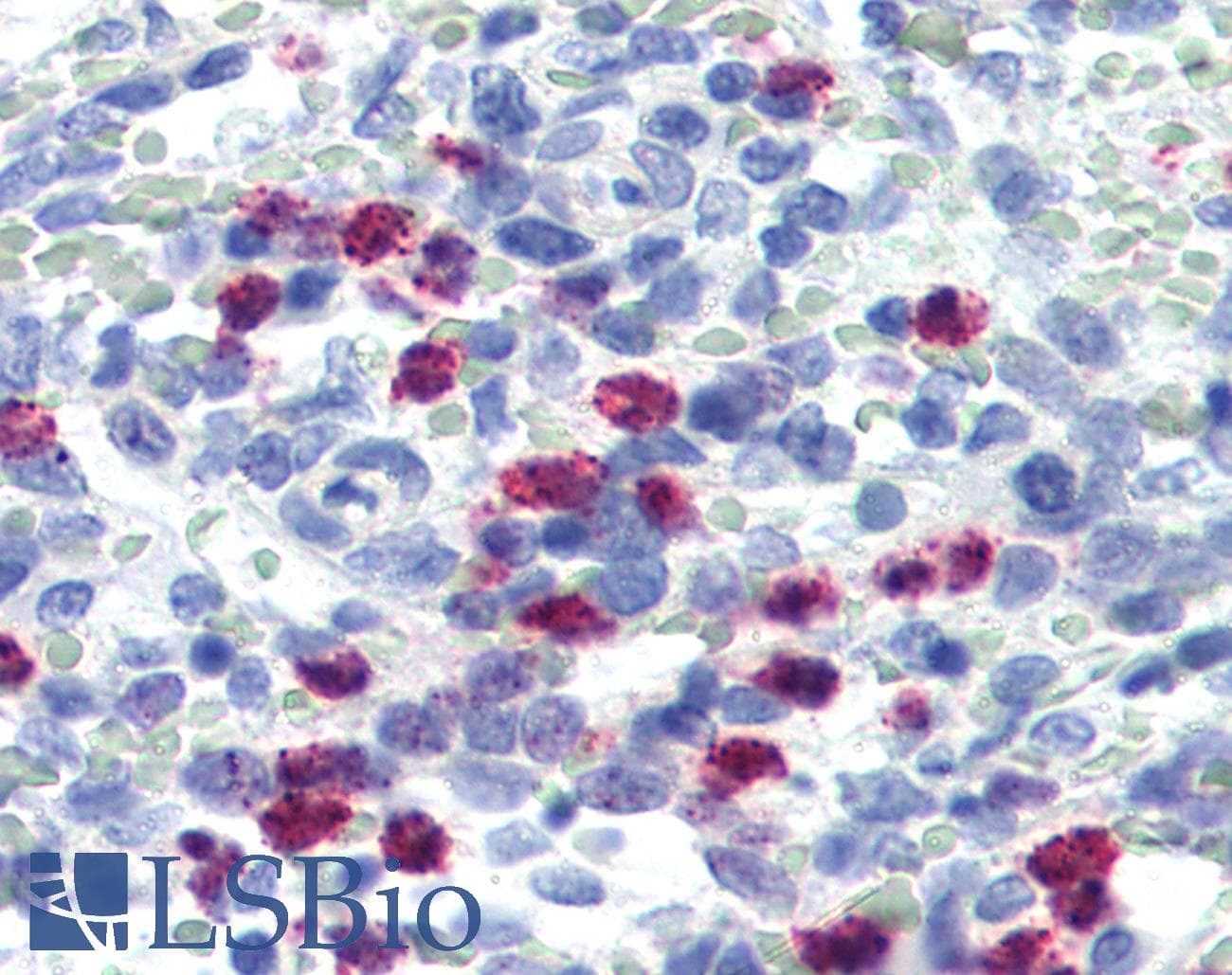 IHC-plus™ FBXW7 / FBW7 Antibody (Internal)
