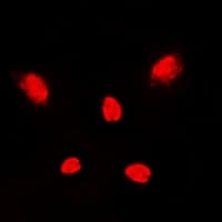 MAPK14 / p38 Antibody (C-Terminus)