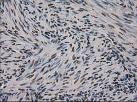 Monoclonal Mouse anti-Human MKI67 / Ki67 Antibody (clone OTI3D11, IHC, WB)