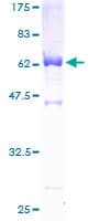 Human PDLIM3 Protein (Recombinant GST)