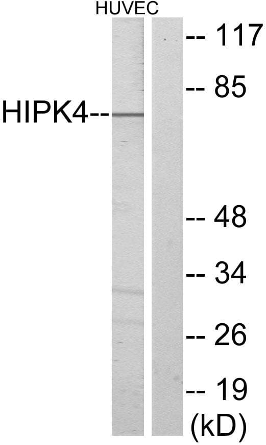 Polyclonal Rabbit anti-Human HIPK4 Antibody (IHC, IF, WB)