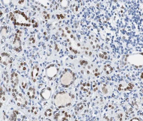 BRCA1 Antibody (phospho-Ser1524)